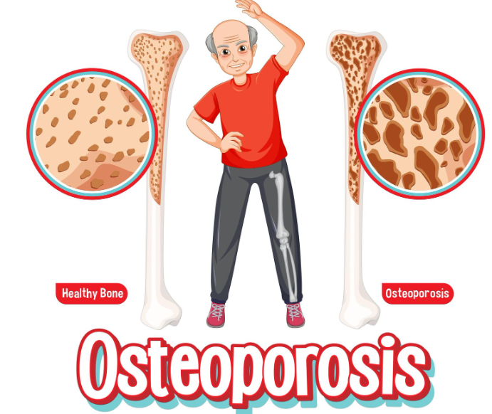 strengthen your bones and prevent osteoporosis